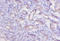 Cathepsin K antibody, LS-C285483, Lifespan Biosciences, Immunohistochemistry paraffin image 