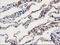 Annexin A3 antibody, LS-C172488, Lifespan Biosciences, Immunohistochemistry paraffin image 