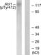 ABL Proto-Oncogene 1, Non-Receptor Tyrosine Kinase antibody, LS-C198582, Lifespan Biosciences, Western Blot image 