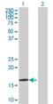 Crystallin Gamma D antibody, H00001421-D01P, Novus Biologicals, Western Blot image 