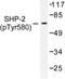 Protein Tyrosine Phosphatase Non-Receptor Type 11 antibody, LS-C177950, Lifespan Biosciences, Western Blot image 