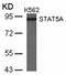 Signal Transducer And Activator Of Transcription 5A antibody, orb14462, Biorbyt, Western Blot image 