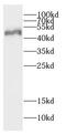 Carbonic Anhydrase 14 antibody, FNab01160, FineTest, Western Blot image 