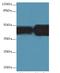 Acyl-CoA Dehydrogenase Long Chain antibody, LS-B15210, Lifespan Biosciences, Western Blot image 