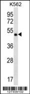 Coiled-Coil Domain Containing 71 antibody, 56-456, ProSci, Western Blot image 