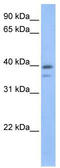 VPS26, Retromer Complex Component B antibody, TA340216, Origene, Western Blot image 