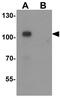 Calcium/Calmodulin Dependent Serine Protein Kinase antibody, GTX31858, GeneTex, Western Blot image 