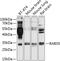 RAB35, Member RAS Oncogene Family antibody, 23-360, ProSci, Western Blot image 
