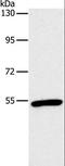 Oxytocin Receptor antibody, LS-C406636, Lifespan Biosciences, Western Blot image 