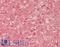 Haptoglobin antibody, LS-B14985, Lifespan Biosciences, Immunohistochemistry paraffin image 