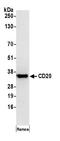 CD20 antibody, A500-017A, Bethyl Labs, Western Blot image 