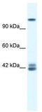 Glutamate Ionotropic Receptor NMDA Type Subunit 2C antibody, TA338511, Origene, Western Blot image 