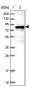 Diacylglycerol Kinase Alpha antibody, PA5-59661, Invitrogen Antibodies, Western Blot image 