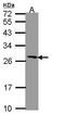 Progesterone Receptor Membrane Component 1 antibody, GTX108532, GeneTex, Western Blot image 