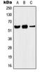 Potassium Voltage-Gated Channel Subfamily A Member 5 antibody, orb214150, Biorbyt, Western Blot image 