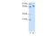 TOX High Mobility Group Box Family Member 4 antibody, PA5-41558, Invitrogen Antibodies, Western Blot image 