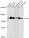 Coagulation Factor XIII A Chain antibody, GTX66274, GeneTex, Western Blot image 