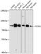 Coagulation factor XIII A chain antibody, GTX66274, GeneTex, Western Blot image 