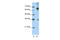 Wnt Family Member 9B antibody, 29-538, ProSci, Enzyme Linked Immunosorbent Assay image 