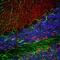 Synuclein Alpha antibody, M00215-3, Boster Biological Technology, Immunofluorescence image 