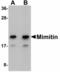 NADH:Ubiquinone Oxidoreductase Complex Assembly Factor 2 antibody, LS-B5045, Lifespan Biosciences, Western Blot image 