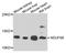 Nascent polypeptide-associated complex subunit alpha antibody, orb373058, Biorbyt, Western Blot image 