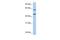 Netrin 4 antibody, GTX10631, GeneTex, Western Blot image 