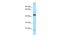 Eukaryotic Translation Initiation Factor 2B Subunit Beta antibody, A04021, Boster Biological Technology, Western Blot image 