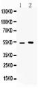 Cerebellar Degeneration Related Protein 2 antibody, A02973-1, Boster Biological Technology, Western Blot image 