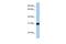 Beta-1,3-Galactosyltransferase 6 antibody, GTX45882, GeneTex, Western Blot image 