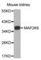 Mitogen-Activated Protein Kinase Kinase 6 antibody, abx000573, Abbexa, Western Blot image 