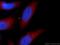Tripartite Motif Containing 63 antibody, 55456-1-AP, Proteintech Group, Immunofluorescence image 