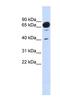 Mannosidase Alpha Class 1A Member 2 antibody, NBP1-60058, Novus Biologicals, Western Blot image 