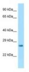 Hypoxanthine Phosphoribosyltransferase 1 antibody, NBP1-98359, Novus Biologicals, Western Blot image 