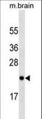 RAB23, Member RAS Oncogene Family antibody, LS-C162365, Lifespan Biosciences, Western Blot image 