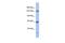 Ataxin 2 antibody, PA5-41439, Invitrogen Antibodies, Western Blot image 