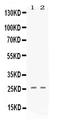 Platelet Factor 4 antibody, PB10011, Boster Biological Technology, Western Blot image 