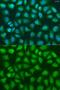 Suppressor Of Cytokine Signaling 4 antibody, GTX33513, GeneTex, Immunofluorescence image 