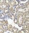 Hexose-6-Phosphate Dehydrogenase/Glucose 1-Dehydrogenase antibody, FNab03741, FineTest, Immunohistochemistry paraffin image 