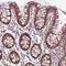 LIAR antibody, HPA071287, Atlas Antibodies, Immunohistochemistry frozen image 