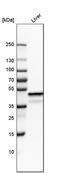 NDRG Family Member 2 antibody, PA5-51767, Invitrogen Antibodies, Western Blot image 