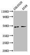 Patatin Like Phospholipase Domain Containing 5 antibody, CSB-PA773803LA01HU, Cusabio, Western Blot image 
