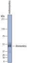 Interleukin 1 Receptor Type 1 antibody, PA5-47903, Invitrogen Antibodies, Western Blot image 