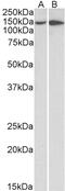 G Protein Nucleolar 3 antibody, 43-624, ProSci, Western Blot image 