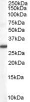 Dimethylarginine Dimethylaminohydrolase 2 antibody, NB100-864, Novus Biologicals, Western Blot image 