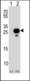 Fortilin antibody, TA324631, Origene, Western Blot image 