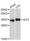 Insulin Like Growth Factor 2 antibody, STJ24138, St John