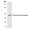 Prostacyclin receptor antibody, LS-B11456, Lifespan Biosciences, Western Blot image 