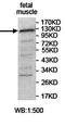 Ubiquitin Specific Peptidase 25 antibody, orb78177, Biorbyt, Western Blot image 