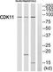 Cyclin Dependent Kinase 11A antibody, TA316484, Origene, Western Blot image 